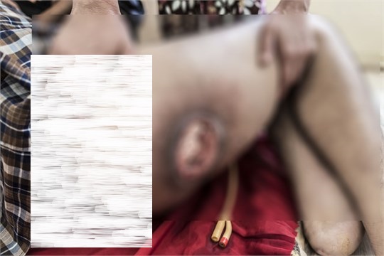 هشت ماه پس از سقوط / تصاویر18+