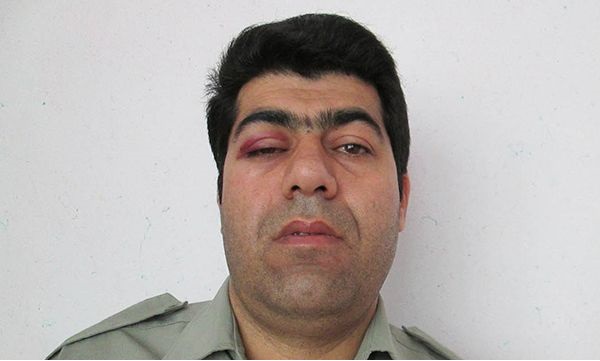 ضرب و شتم رئیس اداره محیط زیست خرمدره توسط شکارچیان غیرمجاز ضرب و شتم رئیس اداره محیط زیست خرمدره توسط شکارچیان غیرمجاز