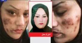 اکسیر جوانی، زیبایی یک زن را گرفت