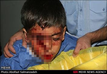 تخلیه چشم در انفجار نارنجک ها تخلیه چشم در انفجار نارنجک ها