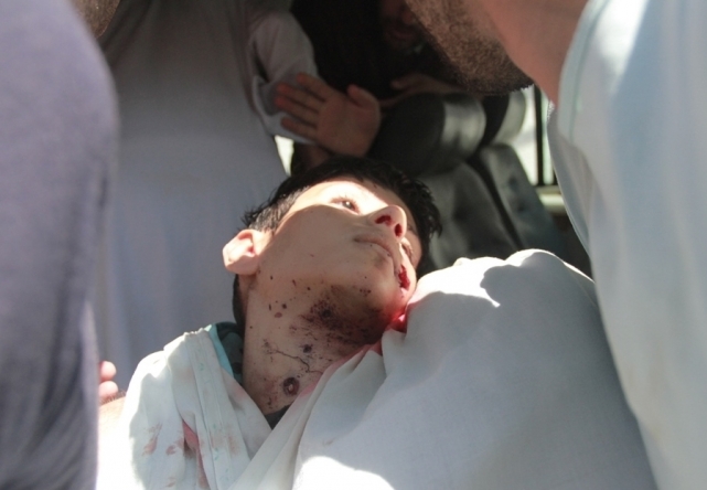 زخمی های حملات هوایی رژیم صهیونیستی