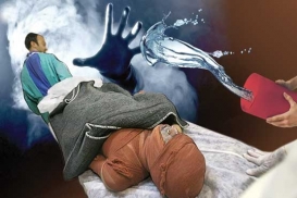 انتقام زن جوان با ​اسیدپاشی به همسر