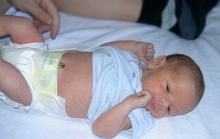 تولد نوزاد،۴ ماه پس ازمرگ مغزی مادرش