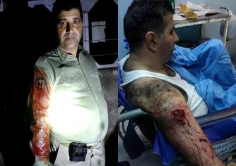 حمله سه شکارچی با داس و چوب دستی به یک محیط بان