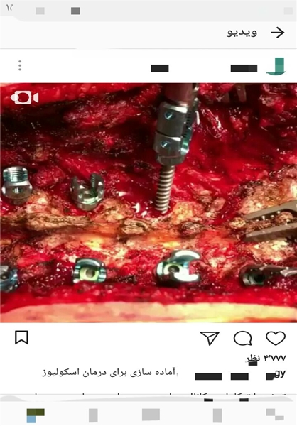 جراحی زنده در اینستاگرام برای جذب مشتری! جراحی زنده در اینستاگرام برای جذب مشتری!