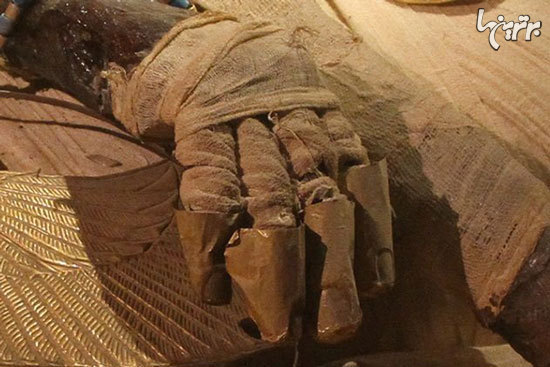 یک زن جنین ۲۵ ساله منجمدی را سالم به دنیا آورد یک زن جنین ۲۵ ساله منجمدی را سالم به دنیا آورد
