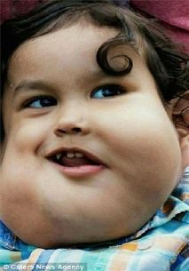 تومور عجیب صورت پسر 4 ساله مکزیکی!