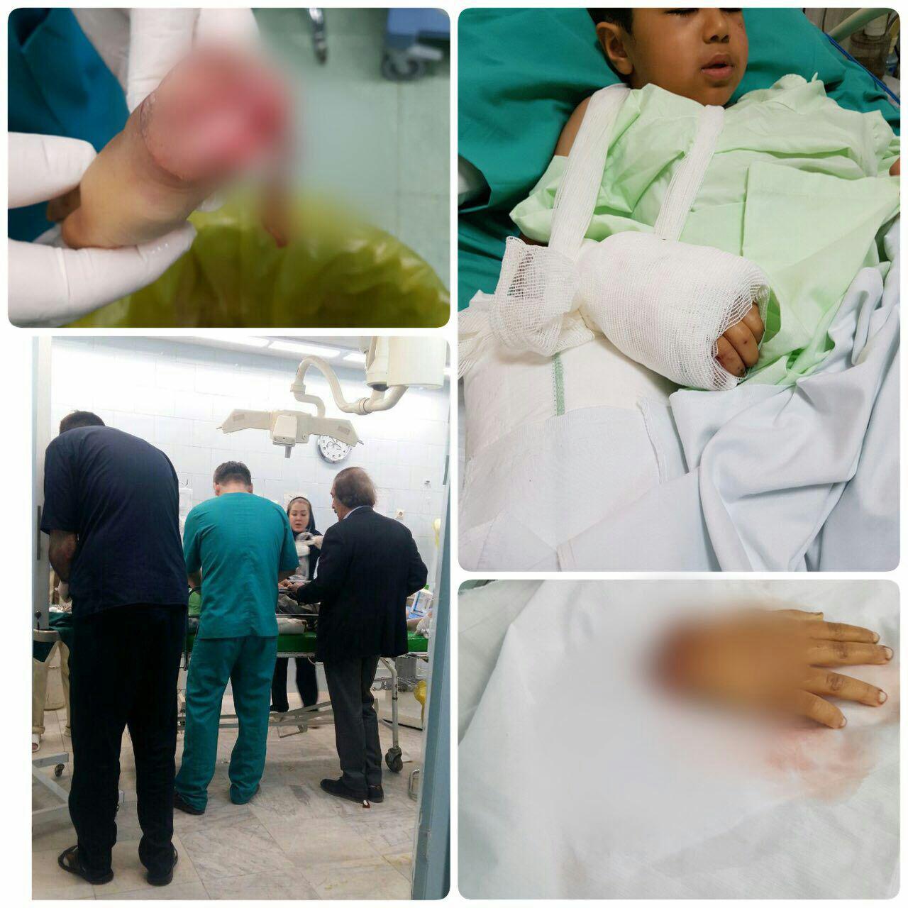 پیوند دست قطع شده کودک زلزله زده