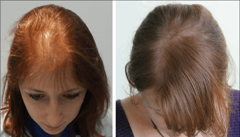 مسابقه دیدنی چیتا با خودروی فرمول یک مسابقه دیدنی چیتا با خودروی فرمول یک