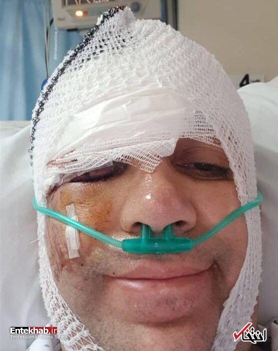 مصدومیت امیر کربلاییزاده در تصادف با اتوبوس مصدومیت امیر کربلاییزاده در تصادف با اتوبوس
