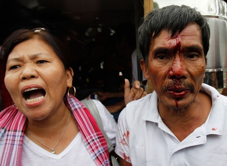 زنی در میان تظاهرکنندگان در برابر سفارت ایالات متحده آمریکا در مانیل، پایتخت فیلیپین به پلیس ضد شورش اعتراض می کند. این زن بر اثر اصابت باتوم مجروح شده است. تظاهرکنندگان فیلیپینی توافقی را که بر مبنای آن حضور نظامیان آمریکایی در این کشور قانونی خواهد بود، محکوم کردند. آنان همچنین به سفر رئیس جمهوری آمریکا به فیلیپین که برای ماه میلادی آوریل برنامه ریزی شده است، اعتراض دارند/رویترز
