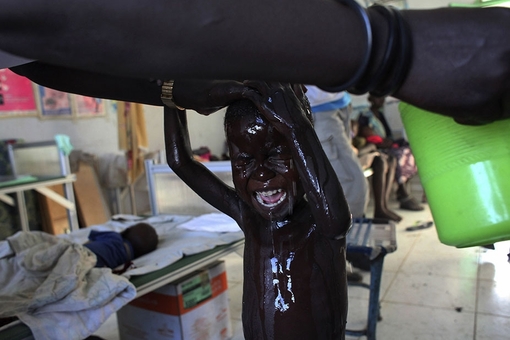 جنگ در ملکال، کودکان سودانی را آواره کرده است و شماز بسیاری از آنان از سوءتغذیه رنج می‌برند. این تصویر در یک مرکز تغذیه تهیه شده است؛ جایی که پزشکان بدون مرز‌ ‌از این کودکان مراقبت می‌کنند. 