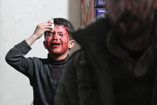 کودک سوری که بر اثر پناه بردن تروریستهای ترسوی ارتش آزاد و افراطیون وابسته به القاعده به محل اقامت خانواده‌ها و غیر نظامیان و بهره گیری از سپر انسانی در برابر حملات نیروهای ارتش سوریه در دوما به شدت زخمی شده است. /REUTERS

