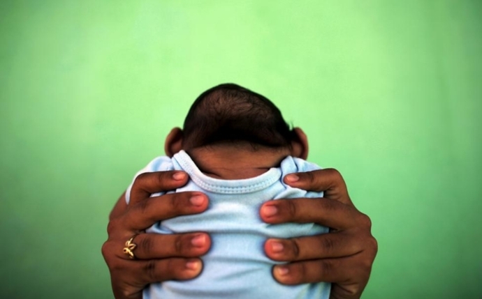 نوزاد 4 ماهه مبتلا به اختلال کوچک بودن مغز در دستان پدرش 