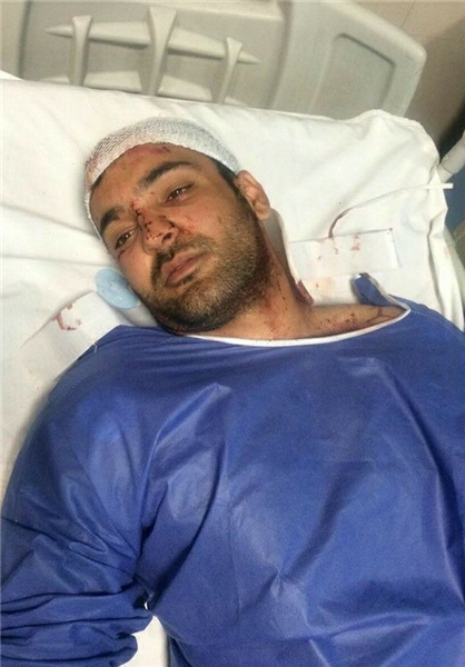 حادثه دلخراش برای ملی پوش دوچرخه سواری ایران در کرمان