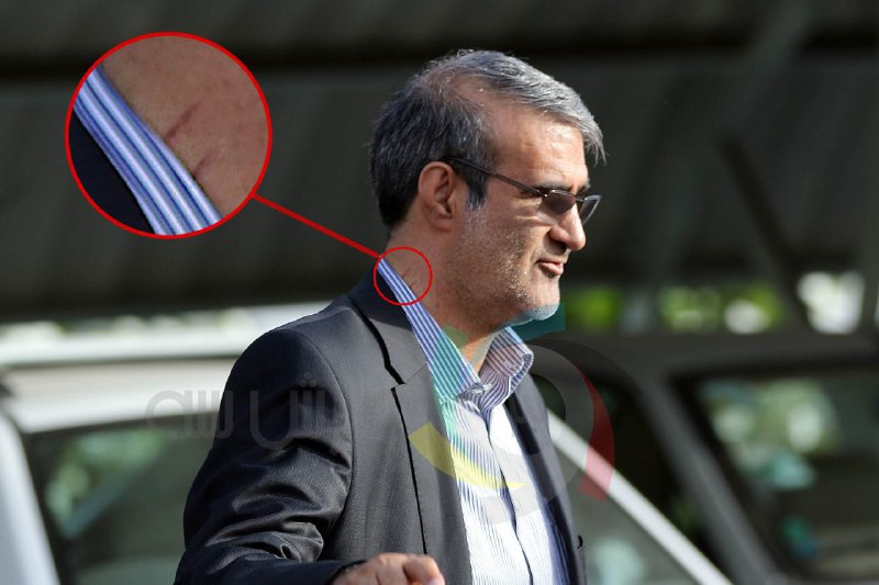 عکس اثرات درگیری فیزیکی قنبرزاده و اسدی روی گردن مدیرعامل نفت!