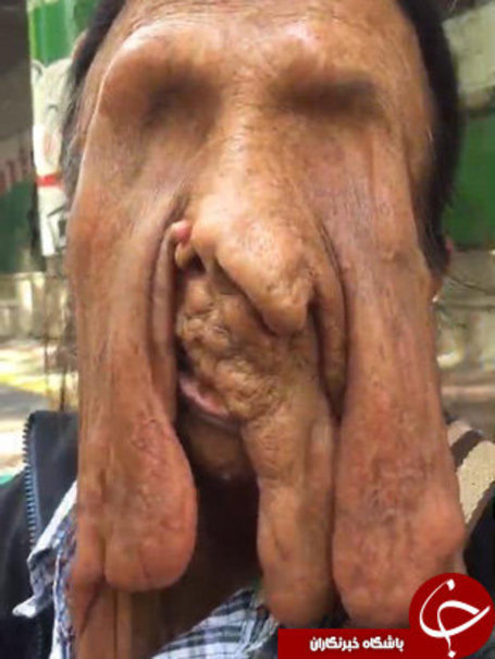 پیرزنی که صورتش در حال ذوب شدن است