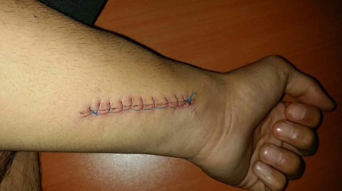 حمله به ۲ طلبه نیشابوری با چاقو حمله به ۲ طلبه نیشابوری با چاقو