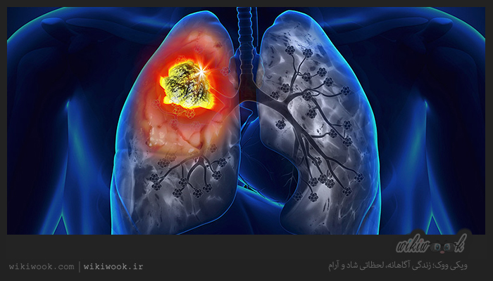 نتیجه تصویری برای بیماری های تنفسی + تابناک