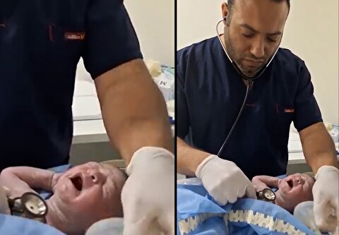 لحظات دلهره آور نجات یک نوزاد توسط پزشک