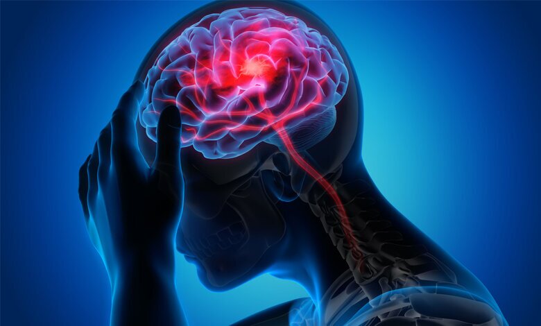علائم سکته مغزی چیست؟!