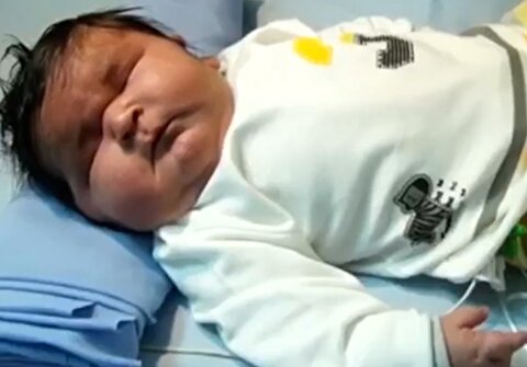 سنگین ترین نوزاد ایرانی به دنیا آمد