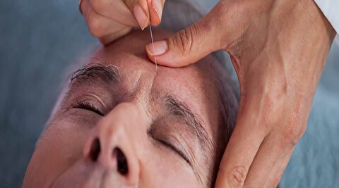 طب سوزنی چگونه گره‌های انرژی بدن را باز می‌کند؟