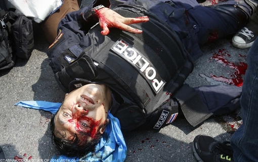 پلیس ضد شورش تایلندی در حالیکه بر اثر انفجار در جریان درگیریهای اخیر معترضان و پلیس زخمی شده، دچار خونریزی شدید شده است 
