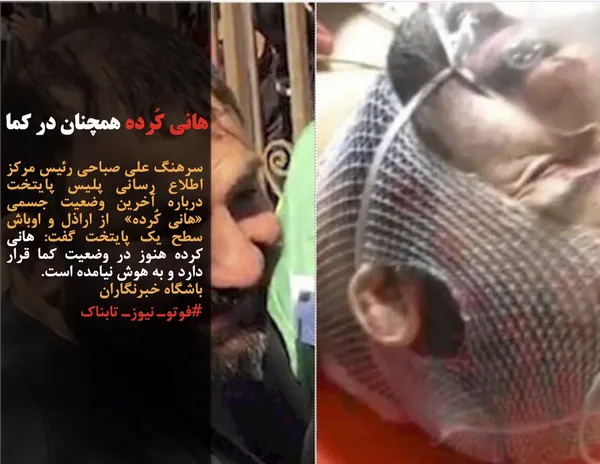 سرهنگ علی صباحی رئیس مرکز اطلاع رسانی پلیس پایتخت درباره آخرین وضعیت جسمی &laquo;هانی کُرده&raquo;  از اراذل و اوباش سطح یک پایتخت گفت: هانی کرده هنوز در وضعیت کما قرار دارد و به هوش نیامده است.
