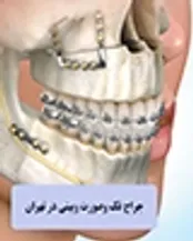دکتر عمل بینی و جراح فک و صورت در تهران
