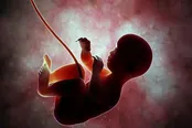 افزایش درخواست برای سقط جنین درمانی