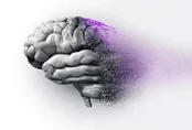 چگونه می‌توان از بروز آلزایمر پیشگیری کرد؟
