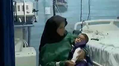 تصاویر جانباز یک ساله ایران در بندرعباس