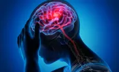 کاهش خطر سکته مغزی با تزریق این واکسن