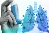 ۱۳ درصد ایرانی‌ها آسم دارند