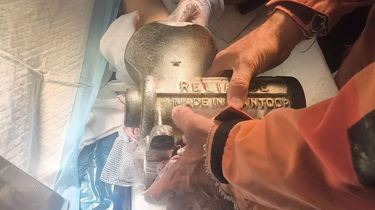 دست زن ۴۸ ساله در چرخ‌گوشت صنعتی گیر کرد