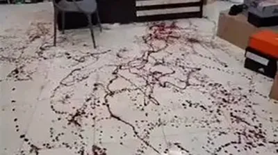 ویدیوی صحنه قطع شدن دست کشتی گیر ملی‌پوش