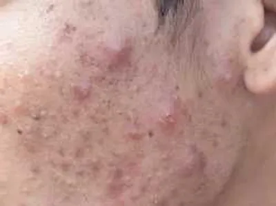 شش محصول آرایشی که هرگز نباید به صورت‌ مالید