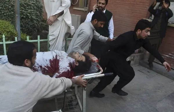 یکی از مجروحان حادثه بمب&zwnj;گذاری مسجد شیعیان در پیشاور پاکستان توسط طالبان پاکستان.
