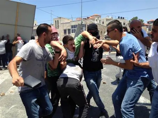 یک نوجوان فلسطینی که به ضرب گلوله صهیونیست&zwnj;ها در شرق بیت المقدس به شدت مجروح شده است./NBC NEWS
