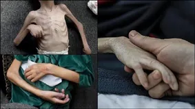 شهادت تلخ و دردناک ۶۰ کودک در غزه