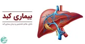 هفت علامت ابتلا به بیماری‌های کبد