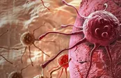 غربالگری ۳ سرطان شایع رایگان شد