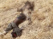 ماجرای جسدی که توسط حیوانات خورده شد