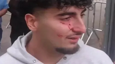 لحظات زد و خورد وحشیانه ضدانقلاب مقابل سازمان ملل