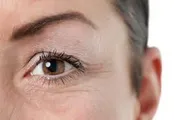 خطوط صورت درباره کدام بیماری‌ها هشدار می‌دهند؟