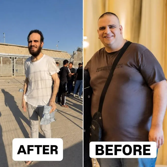 عکس: جنایت صهیونیست‌ها در حق اسرای فلسطینی
