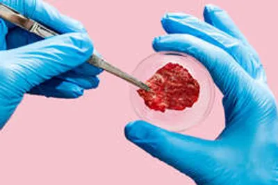انقباض اولین ماهیچه پرورش یافته در آزمایشگاه