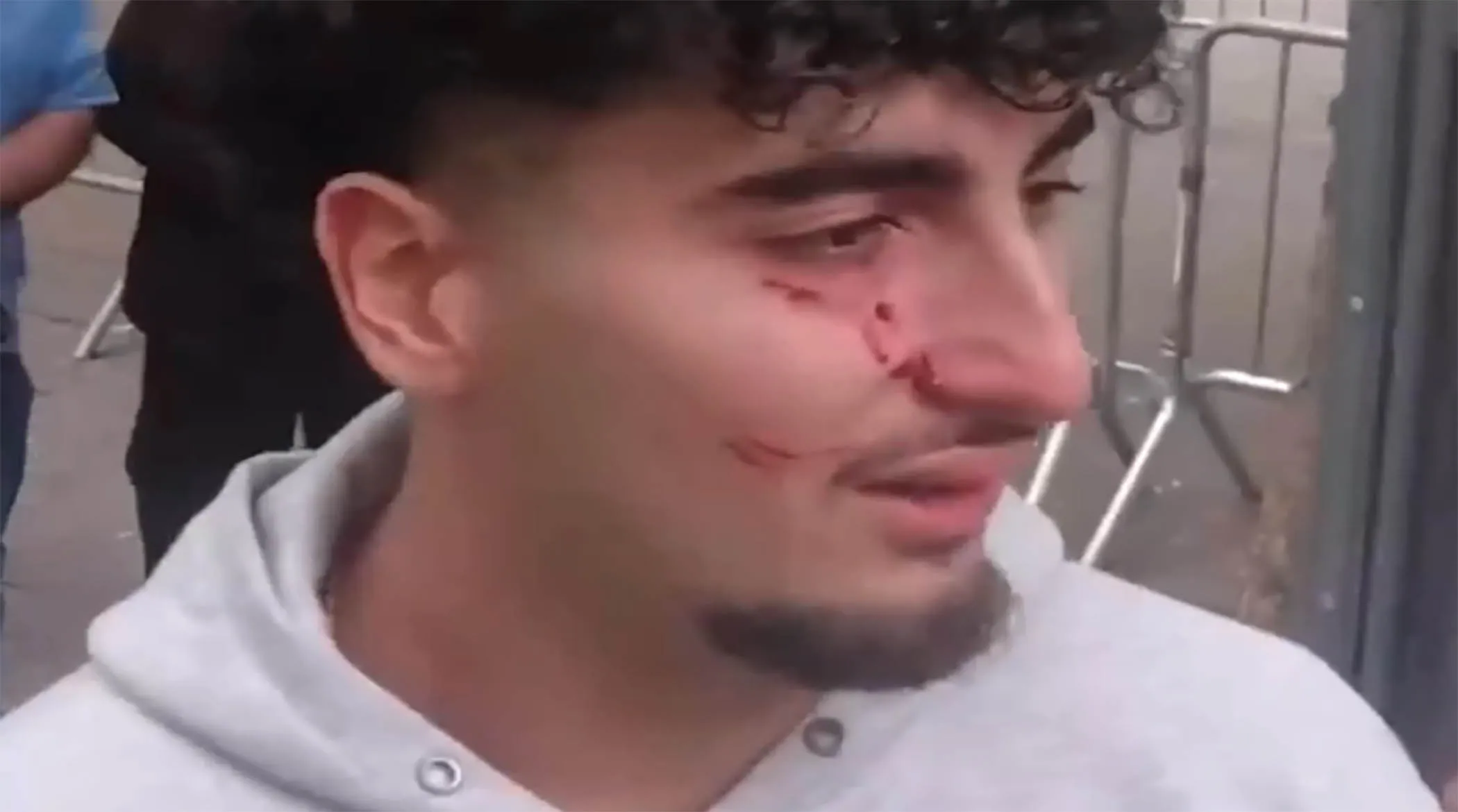 لحظات زد و خورد وحشیانه ضدانقلاب مقابل سازمان ملل